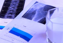 osteoporosis.jpg Лечение остеопороза в Израиле